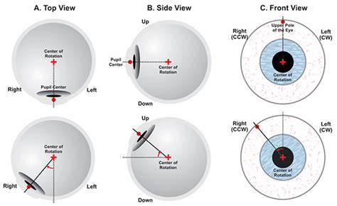 torsional eye movements examples